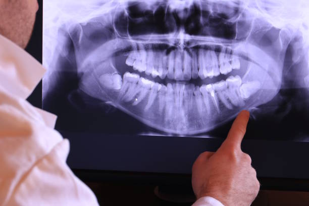 Best Emergency Treatment for Dental Infections or Abscesses in Russell, GA