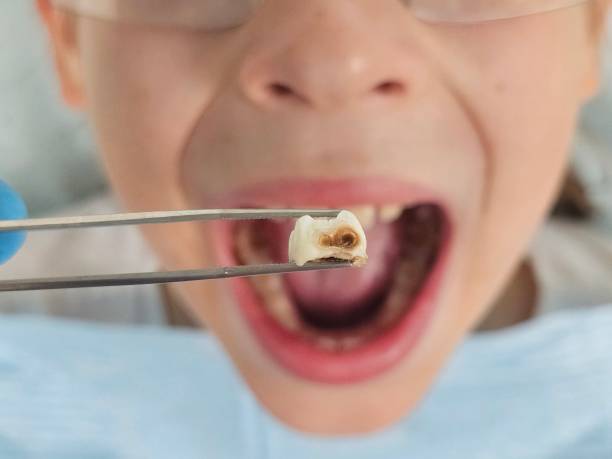 Best Emergency Denture Repair in Russell, GA